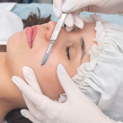 skin treatment with the dermaplaning technique performed with a scalpel by a beautician in a center of aesthetics and beauty of the body and skin